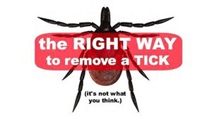 tick removal