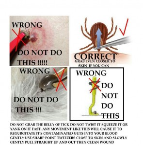 tick removal image